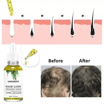 Cuidados do cabelo, Óleo Essencial de Anti-frizz Crescimento de Cabelos Lisos Soro de Óleo de Cabelo Anti Cabelos Perda de Novos Tratamentos de Beleza do Cabelo